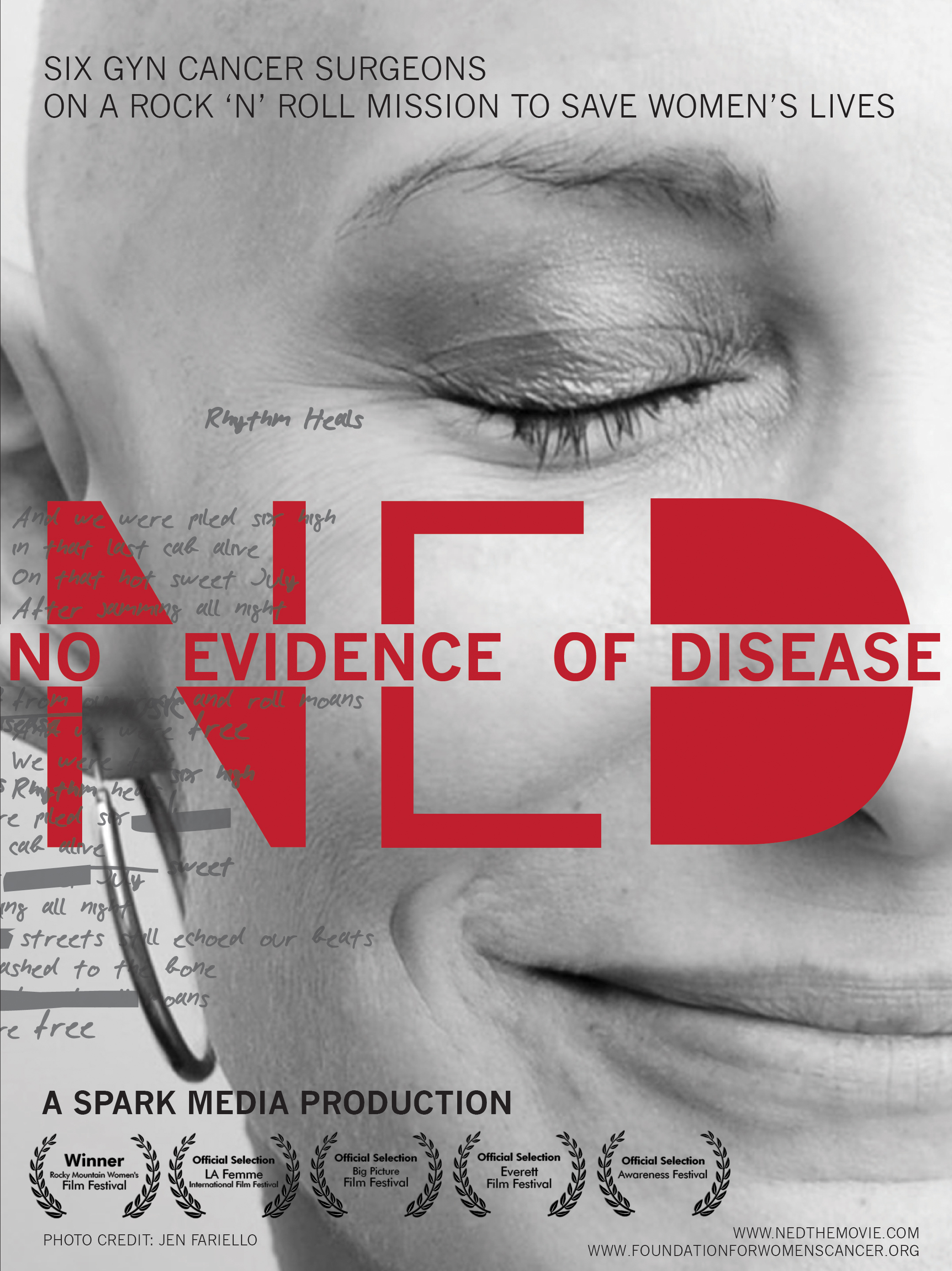 No Evidence of Disease Poster
